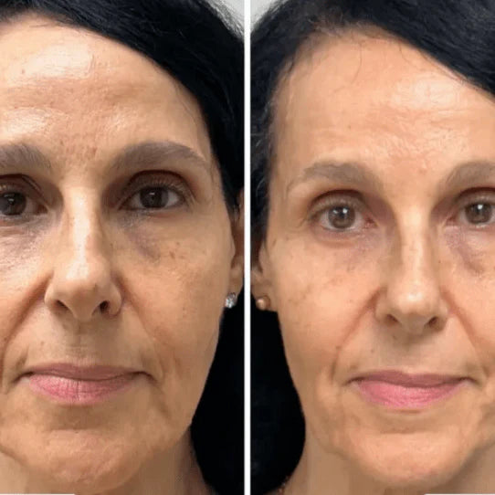 Collagen Fit™ - Maska za pomlađivanje kolagena
